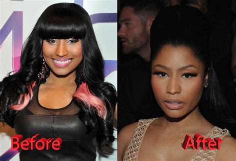 nicki minaj before and after pictures|nicki minaj without plastic surgery.